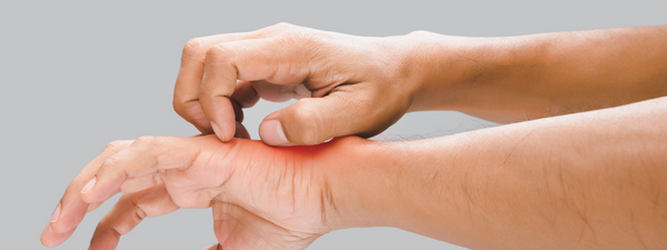 Wat te doen tegen jeuk? Oma weet raadt